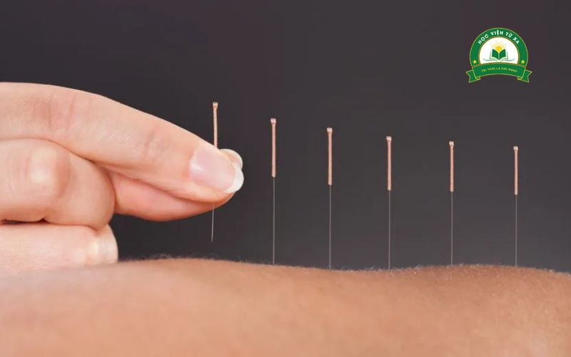 Học Trung cấp Y sĩ Y học cổ truyền có khó không? 